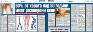 Доц. Андриан Тонев пред в. „Монитор“ – Активният начин на живот намалява опасността от появата на разширени вени